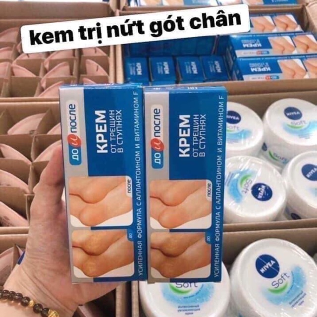 Kem trị nứt gót chân hàng xách tay Nga KPEM