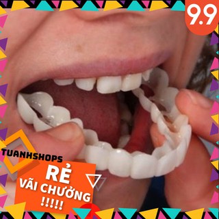 Dụng cụ niềng răng tại nhà snapon smile _