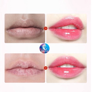 Dưỡng Môi Vaseline Lip Therapy 7g (Dạng Hũ)
