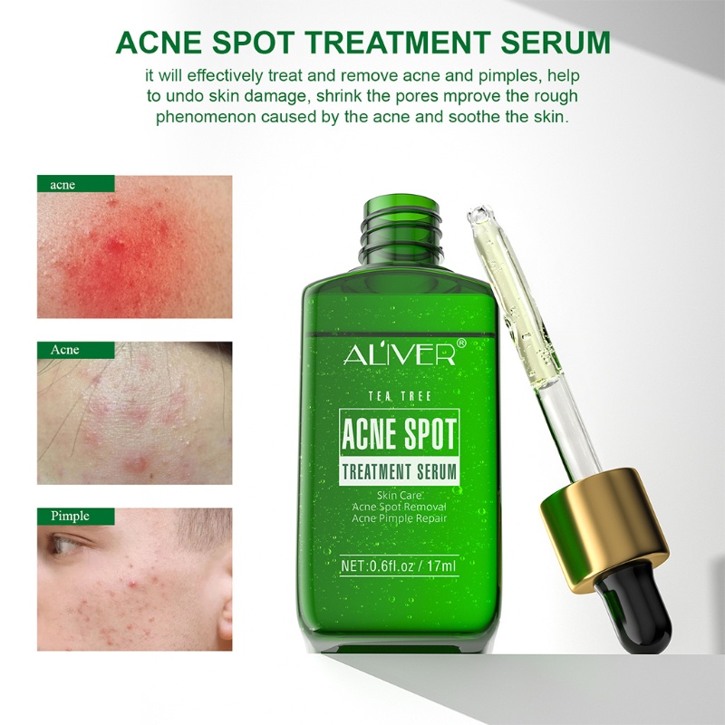 XIXI Serum Hỗ Trợ Giảm Mụn Chiết Xuất Tràm Trà Làm Sạch Da Hiệu Quả
 | BigBuy360 - bigbuy360.vn