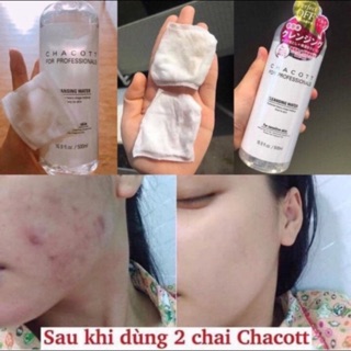 Tẩy trang nước giảm mụn Chacott bản Nhật nội địa
