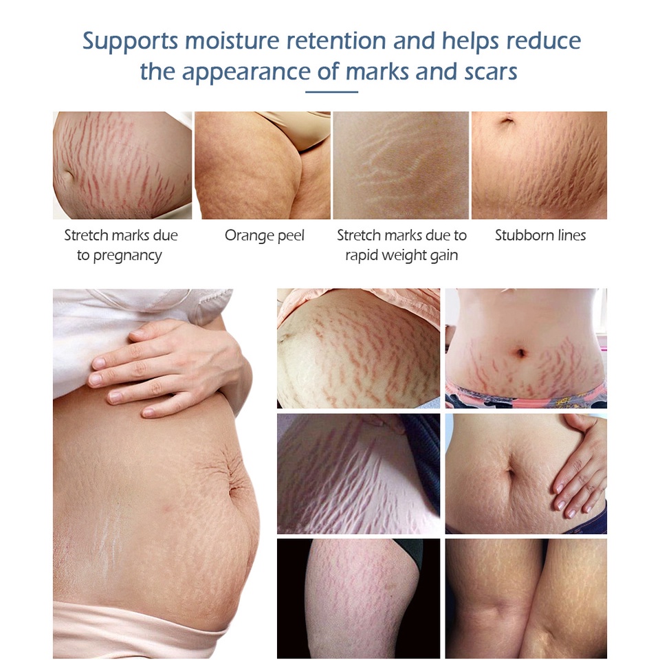 Kem Hỗ Trợ Giảm Sẹo Sau Khi Sinh VIBRANT GLAMOUR Làm Trắng Và Săn Chắc Mịn Mượt Chống Lão Hóa 30g