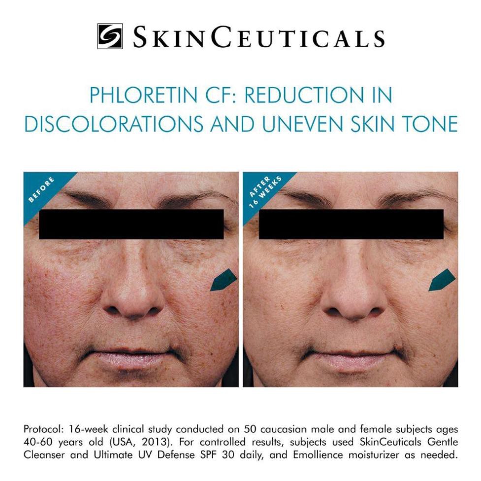 SkinCeuticals Phloretin CF - Tinh Chất Bảo Vệ, Chống Lão Hoá Da 30ml - [Quầy Thuốc Bảo Lâm] -[Chính Hãng]