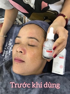 Serum glutathione 700