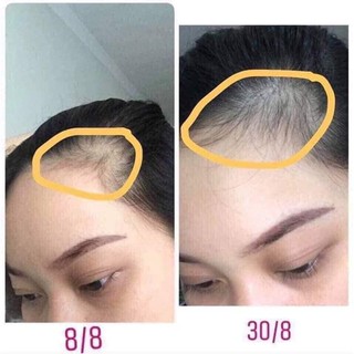 ủ tóc bưởi kích tóc mọc dài mượt