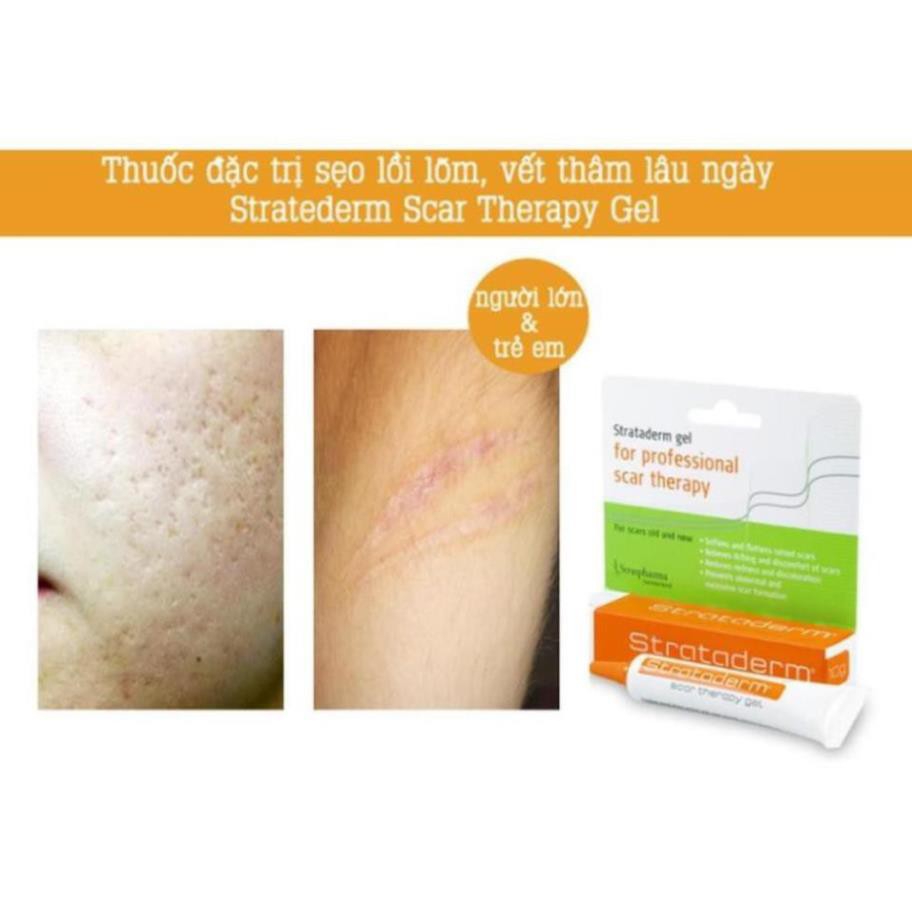  Strataderm 5g 10g 20g Gel hết sẹo cùng chuyên gia | BigBuy360 - bigbuy360.vn