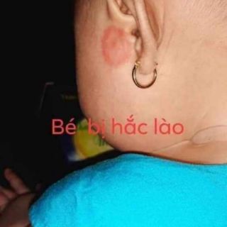 Kem bôi da