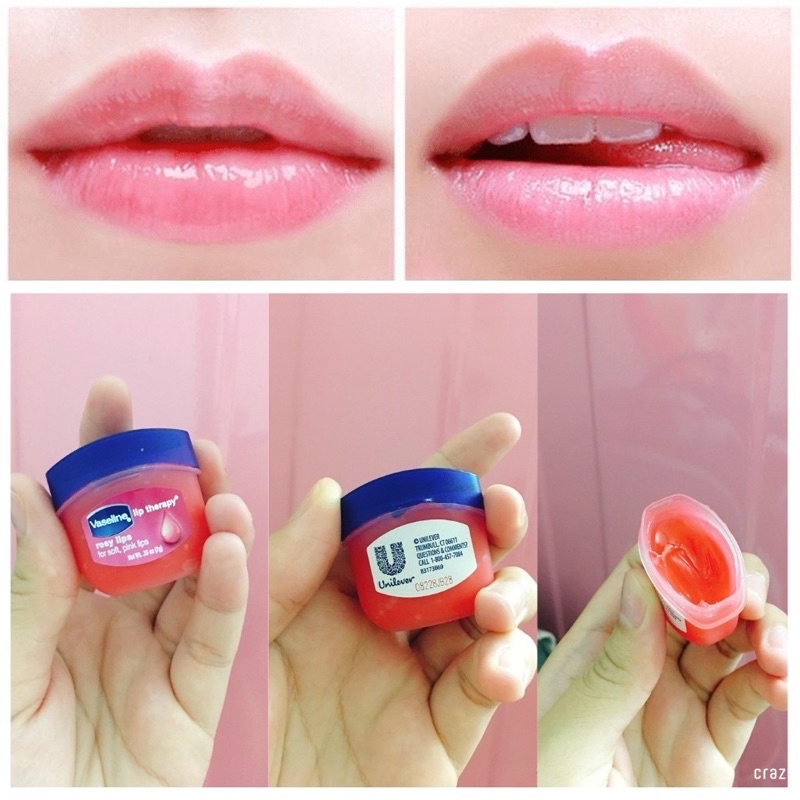 Sáp Dưỡng Môi VASELINE Mỹ Lip Therapy Bảo Vệ Môi Hằng Ngày (7g)