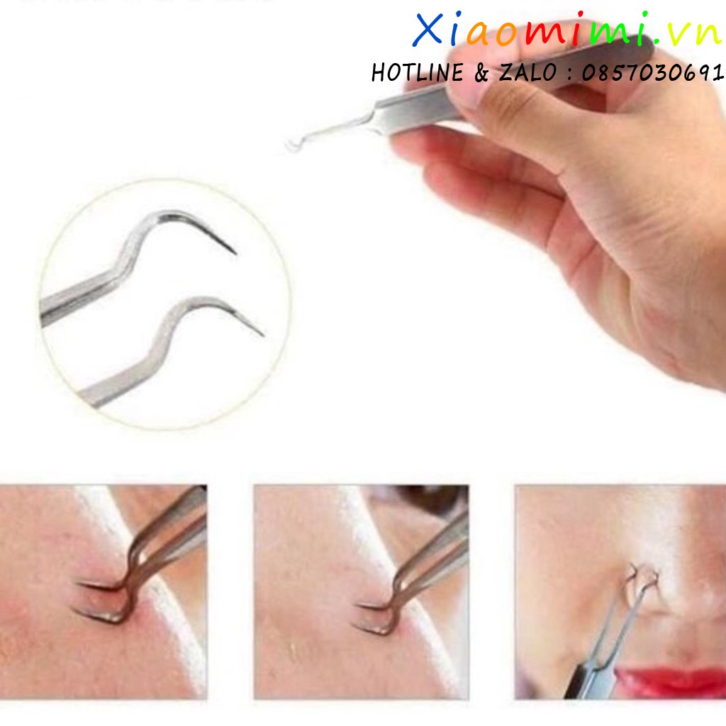 Nhíp gắp mụn đa năng Thần Thánh [Hàn Quốc]