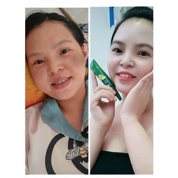Combo Tái Sinh Làn Da Olic- Kem Bơ Olic Và Serum Collagen saffron 7day