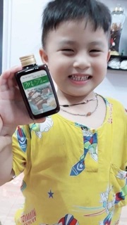 Sâu răng mẹ Tấm