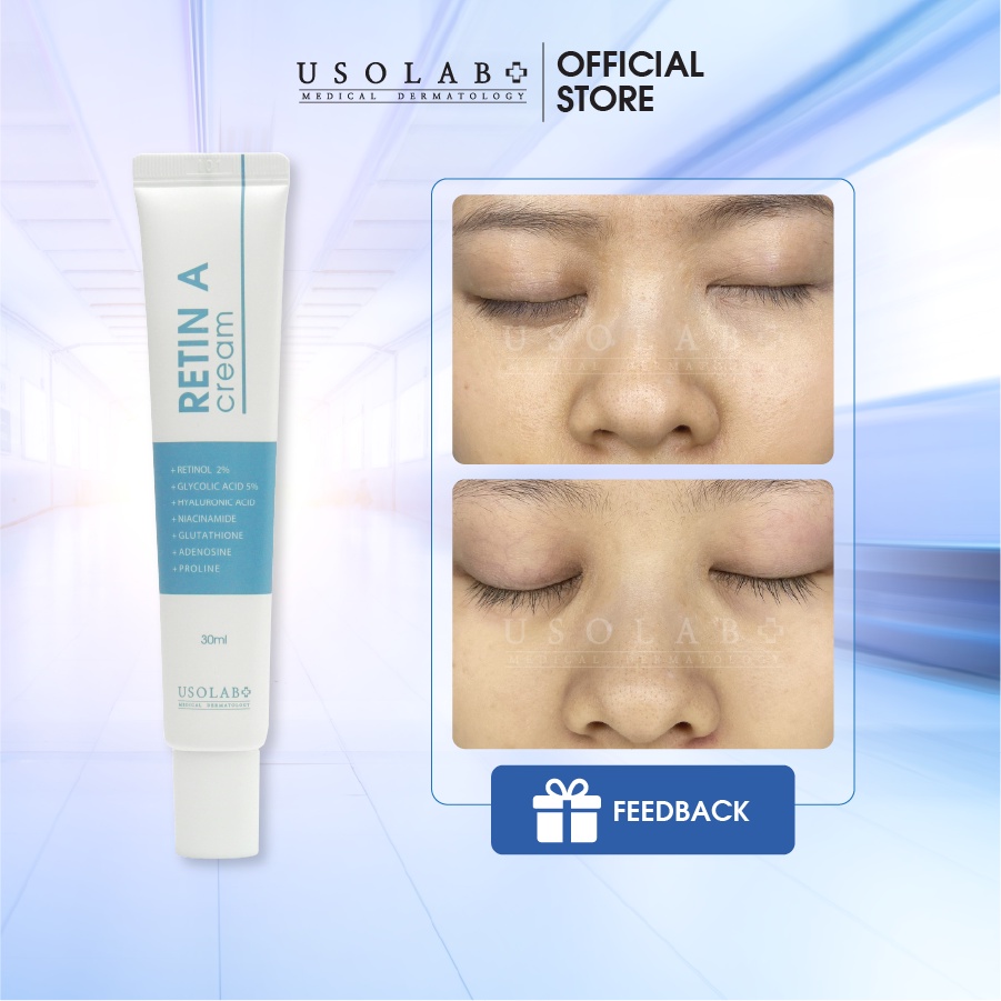 Retinol Usolab 2.0 trẻ hóa, căng bóng, sáng da, giảm mụn Tuyp 30g