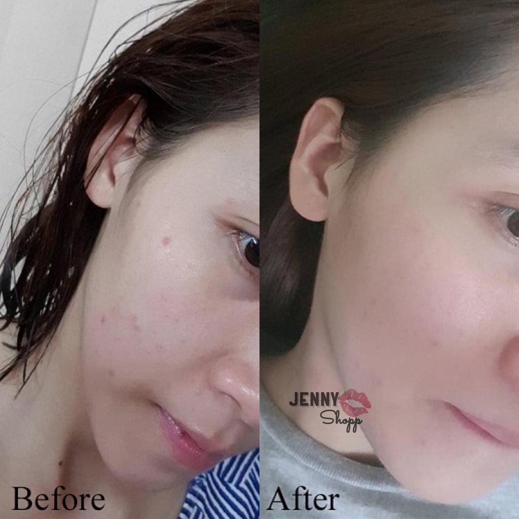 Sữa Rửa Mặt Dạng Gel SVR Sebiaclear Gel Moussant