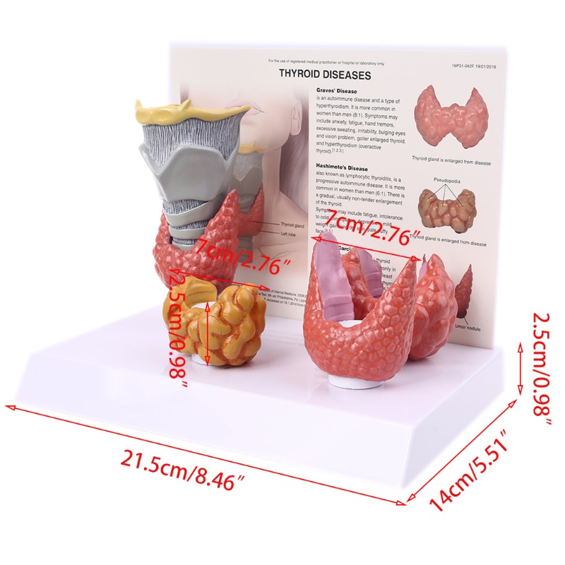 Mô Hình Thyroid Gland Giải Phẫu Hệ Thống Giảng Dạy Con Người