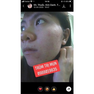 Tái Tạo Thanh Phương (chính hãng)