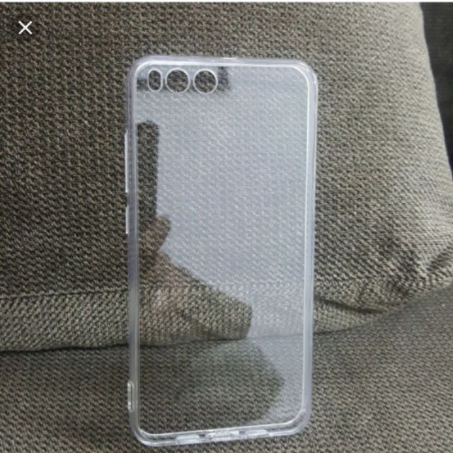 Ốp lưng dẻo trong suốt cho xiaomi mi6