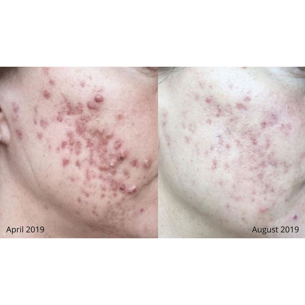 Sữa Rửa Mặt Lumispa Nuskin Auth 100% | BigBuy360 - bigbuy360.vn