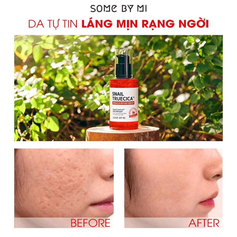 Tinh chất ốc sên đen giảm sẹo lõm sẹo mụn Some By Mi Snail Truecica Miracle Serum 50ml