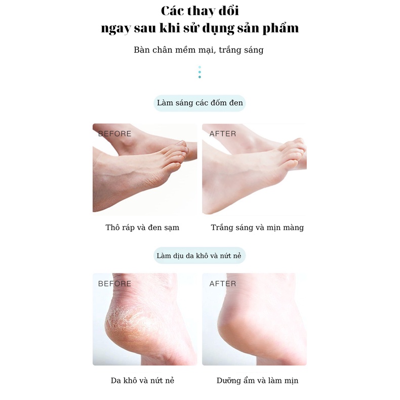 Mặt Nạ LIG Ủ Chân, Tay Lột Da Chết Sữa Dê Nha Đam Sáng Da Và Cung Cấp Dưỡng Ẩm Cho Đôi Bàn Chân, Tay