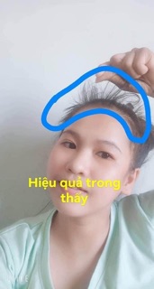 COMBO 3 CHAI TINH DẦU BƯỞI KÍCH MỌC TÓC ( tặng quà hấp dẫn )