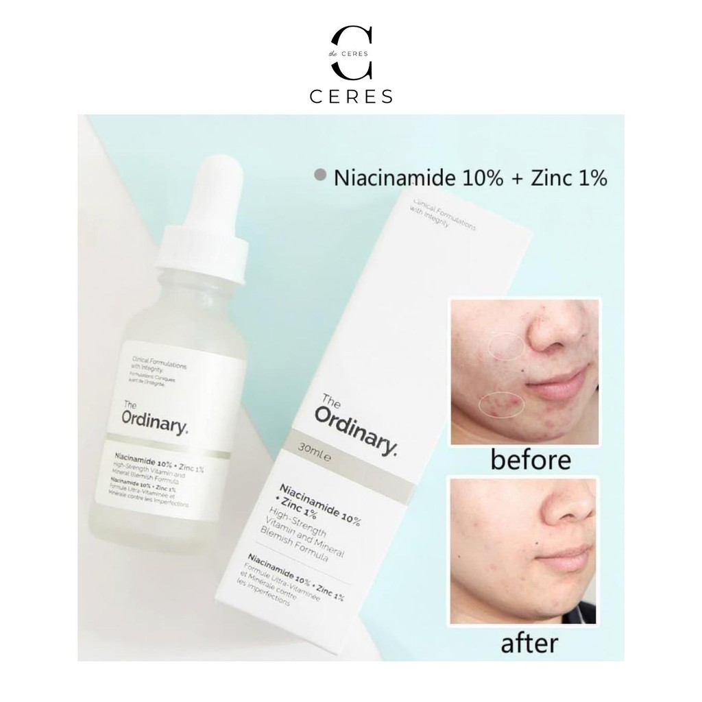 Tinh Chất Niacinamide 10% + Zinc 1% - The Ordinary Serum Giảm Mụn Thu Nhỏ Lỗ Chân Lông