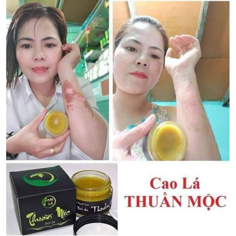 [Chính hãng] Cao Lá Thuần . Mộc Thanh Mộc . Hương - Kem Tri Rạn Da, Nứt Da