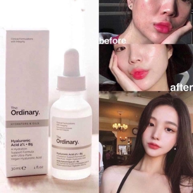 Serum The Ordinary Hyaluronic Acid 2% + B5 Serum cấp nước và hồi phục da