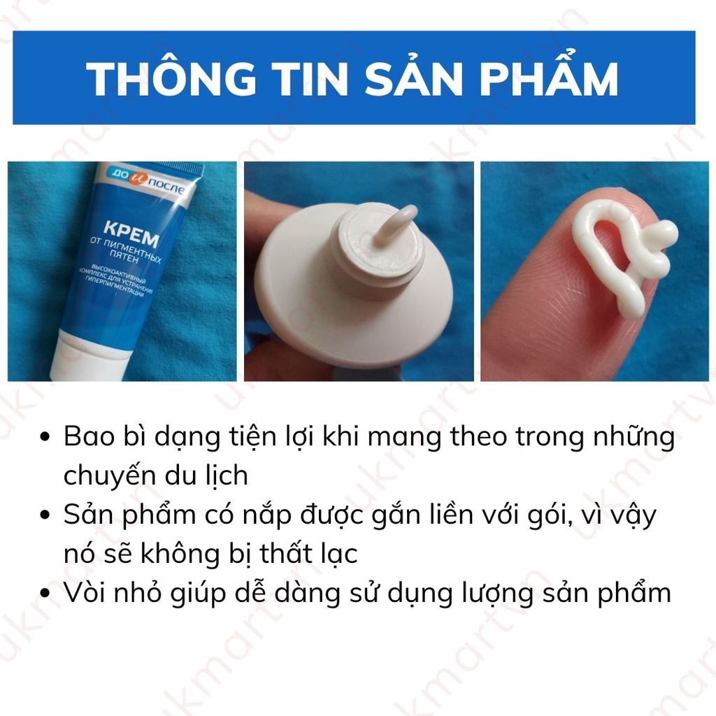 Kem Làm Giảm Đồi Mồi, Vết Nám, Sạm, Đốm Nâu Tay Chân Kpem Nga