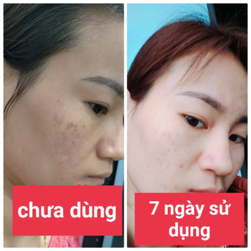 Tinh chất nám linh hương(hàng chính hãng)