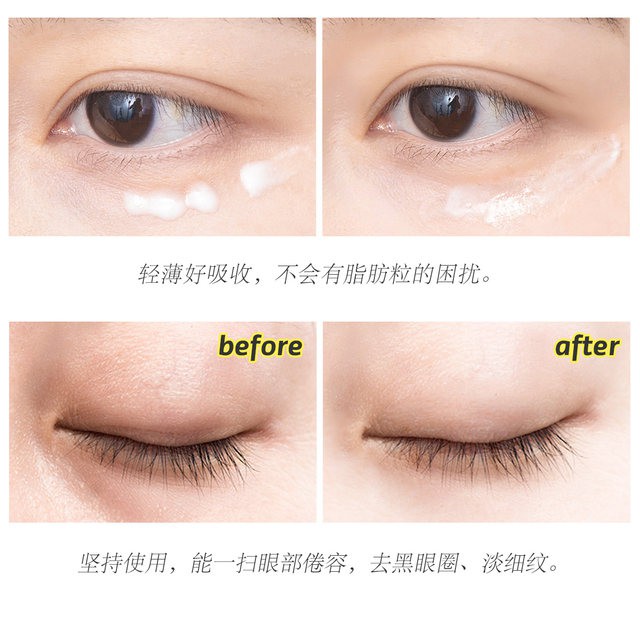 Kem Dưỡng Mắt Giảm Thâm Meishoku Whitening Eye Cream