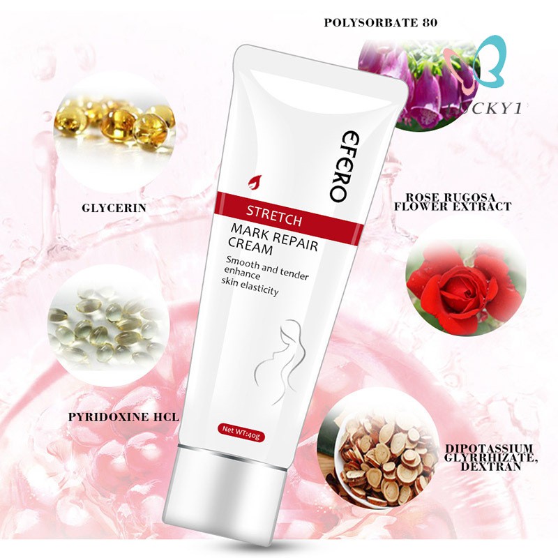 [Hàng mới về] Kem chữa sẹo và rạn da hiệu quả cho phụ nữ sau sinh  | BigBuy360 - bigbuy360.vn
