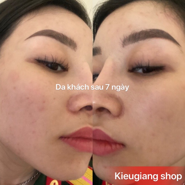 Serum caramel essence( 1 tuần dùng không hiệu quả được đổi trả hoàn tiền) | BigBuy360 - bigbuy360.vn