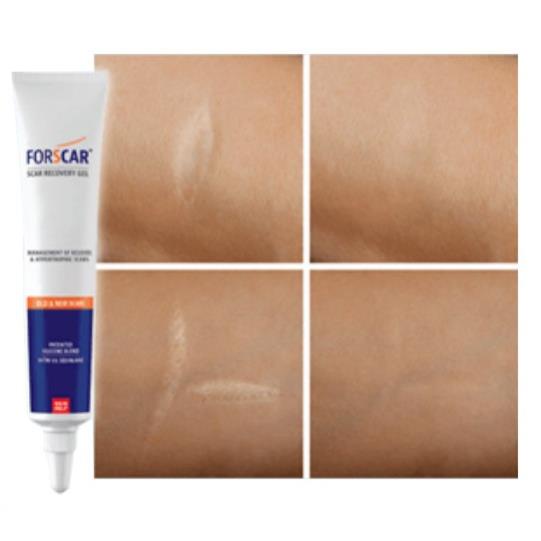 {Hàng Nhập} Gel mờ Sẹo Forscar Scar Recovery Gel 10g giúp giảm vết thâm, sẹo lồi, lõm, giúp hồi phục da