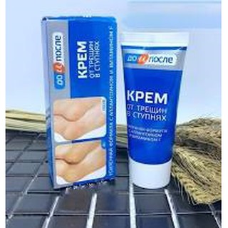 Kem trị nứt gót chân Kpem 50ml