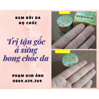 [CHÍNH HÃNG] KEM BÔI  HỌ CHÚC