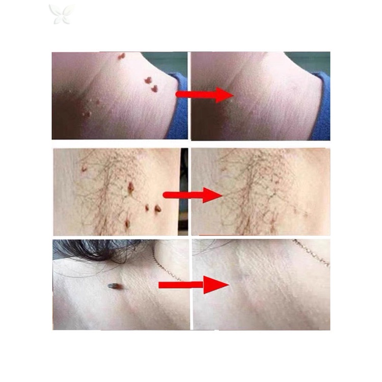 Kem Dưỡng Da Mặt JMMZ Xóa Mờ Nếp Nhăn / Mụn / Đốm Nâu Hiệu Quả