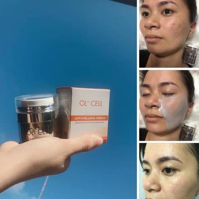 OL- CELL hỗ trợ nám tàn nhang ol cell