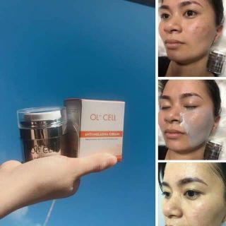 OL- CELL hỗ trợ nám tàn nhang ol cell