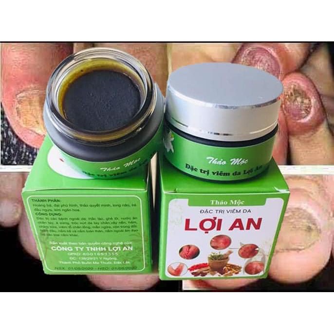 Thảo Mộc Lợi An - Thuo.c Tri Nấm Ngứa, Nấm Móng, Nấm Da Đầu, Vảy Nến, Á Sừng, Viem Da, Viem Da Cơ Địa, Viêm Lỗ Chân Lông | BigBuy360 - bigbuy360.vn