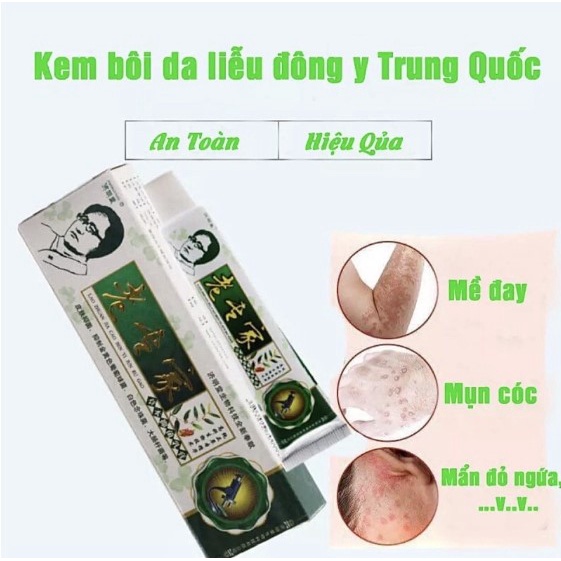 Kem bôi ngoài da Á Sừng chuyên nấm ngứa, chàm, tổ đỉa, ghẻ nước...m