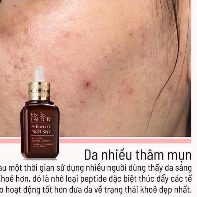 Tinh chất phục hồi da Serum Estee Lauder Advanced Night Repair