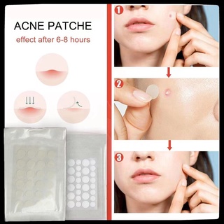 Set 36 miếng dán hỗ trợ giảm mụn vô hình