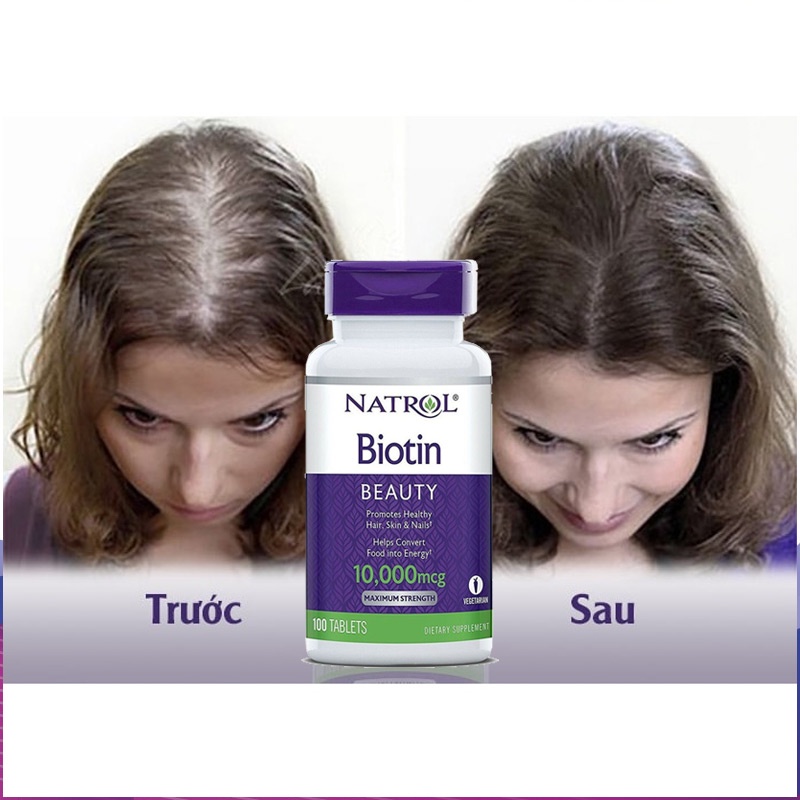 Viên Uống Mọc Tóc Natrol Biotin 10000 Mcg 100 Viên Của Mỹ