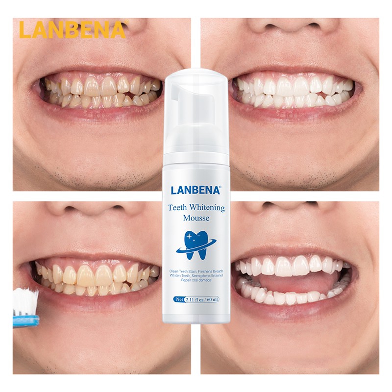 Tinh chất làm trắng răng khử mùi hôi miệng kem đánh răng làm sạch răng tẩy vết ố Whitening Teeth Toothpaste Mousse