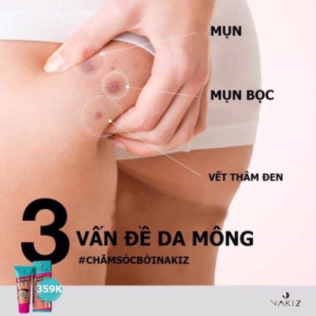 COMBO 3 NAKIZ LIVELY BUTT【CHÍNH HÃNG】 Kem mờ thâm, mụn Mông, Bẹn, Nách, Lưng, Nhũ hoa, Cùi chỏ, Đầu gối .... Thái Lan | BigBuy360 - bigbuy360.vn