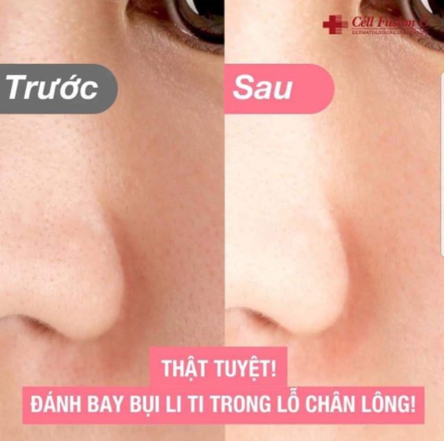 Mặt Nạ Sủi Bọt Se Khít Lỗ Chân Lông CELL FUSION C PORE DELETE BUBBLE PACK