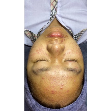 Serum đường đen Black sugar ♥️ Chính Hãng | BigBuy360 - bigbuy360.vn