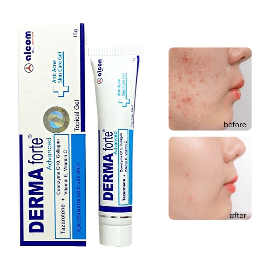 Gel Giảm Mụn, Thâm Sẹo Và Dưỡng Da Gamma DERMA FORTE Gel 15g - Bản Advance