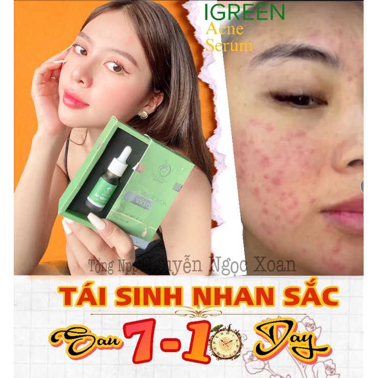 Serum IGREEN Diếp cá Sạch mụn, mờ thâm, thu nhỏ lỗ chân lông 10ml | BigBuy360 - bigbuy360.vn