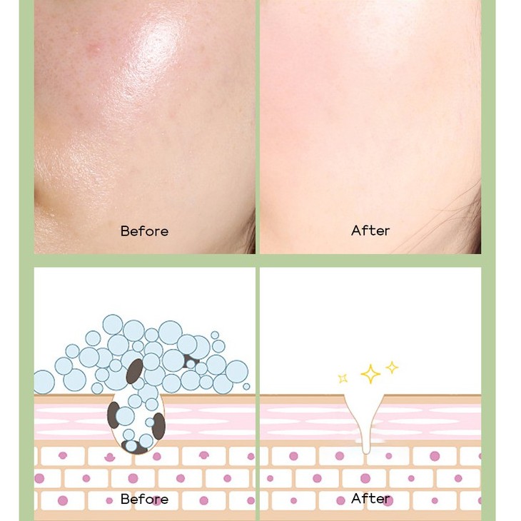 Hộp 20 gói mặt nạ bùn làm sạch da kiềm dầu trà xanh Fenyi Green Tea Mud Mask Sena Beauty